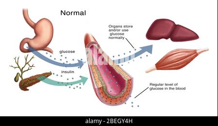 Produzione normale di insulina/glucosio Foto Stock