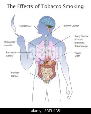 Effetti del fumo di tabacco Foto Stock