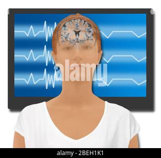 Terapia biofeedback Foto Stock