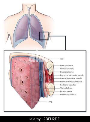 Una sezione illustrata di un polmone e della gabbia a coste che mostra diversi strati di tessuto e muscolo. La pleura (blu) è una membrana sierosa che copre i polmoni (pleura viscerale) e la parete toracica (pleura parietale), creando uno spazio riempito di fluido (cavità pleurica) che lubrifica i polmoni per aiutare a respirare. Tra ogni costola si trovano una serie di muscoli intercostali, arterie, vene e nervi. Uno strato di fascia endotoracica allinea anche la superficie interna della gabbia a coste. Foto Stock