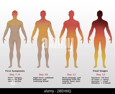 Progressione di Ebola, illustrazione Foto Stock