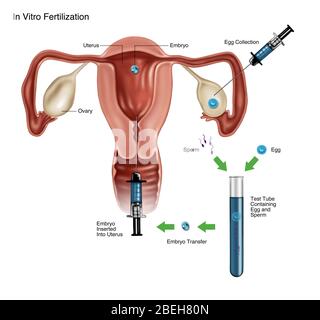 Fertilizzazione in vitro Foto Stock