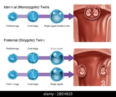 Sviluppo di Twins, illustrazione Foto Stock