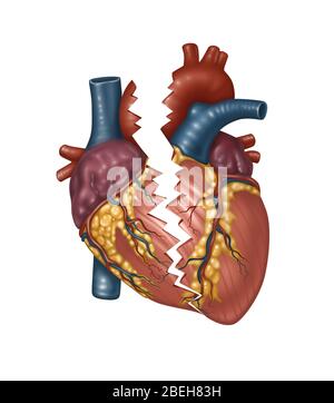 Illustrazione di un cuore rotto Foto Stock