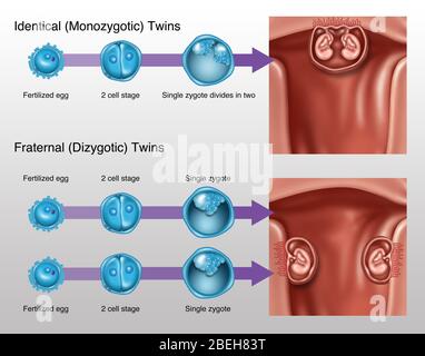 Sviluppo di Twins, illustrazione Foto Stock