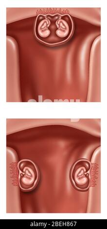 Sviluppo di Twins, illustrazione Foto Stock