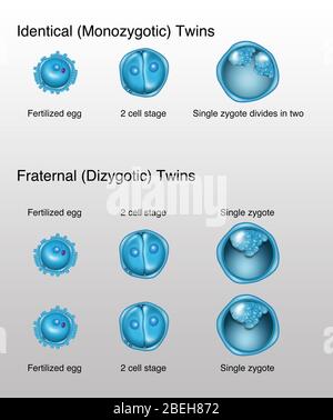 Sviluppo di Twins, illustrazione Foto Stock