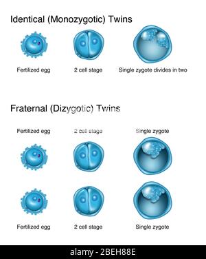Sviluppo di Twins, illustrazione Foto Stock
