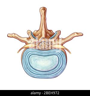 Vertebra lombare e disco, illustrazione Foto Stock