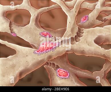 Osteoclasti, illustrazione Foto Stock