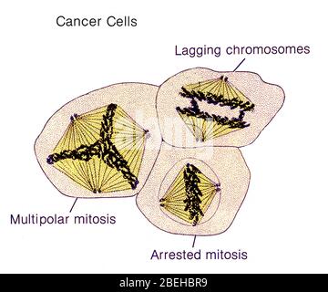 Cellule tumorali, illustrazione Foto Stock