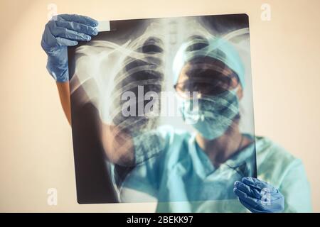 Immagine concettuale di un medico che tiene e analizza una radiografia di alcuni polmoni. Foto Stock