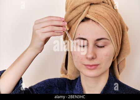 donna millenaria che indossa un accappatoio applica olio di oliva alla sua acne Foto Stock