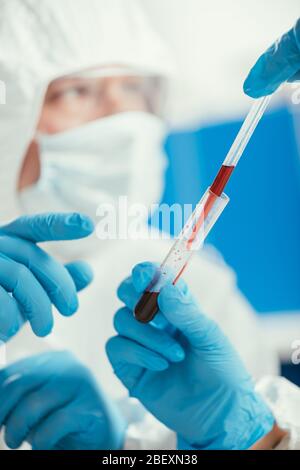 vista ritagliata della pipetta e della provetta di biochimica con il campione di sangue vicino al collega Foto Stock