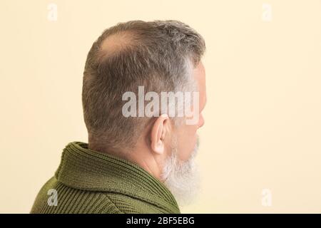 Uomo anziano con problema di perdita dei capelli su sfondo di colore Foto Stock