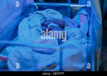 Un neonato con elevata bilirubina si trova sotto una lampada blu, fototerapia Foto Stock