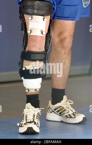 Un paziente uomo che cammina indossando un ginocchiera Donjoy dotato di pennarelli riflettenti utilizzati per misurare il comfort. Foto Stock