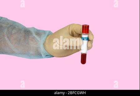 Mano che trattiene il campione di sangue in una provetta sottovuoto. Risultato positivo del test per il nuovo Coronavirus a rapida diffusione Foto Stock