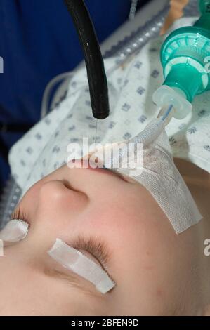 Bambino giovane sottoposto ad esame endoscopico. Foto Stock