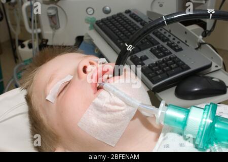 Bambino giovane sottoposto ad esame endoscopico. Foto Stock