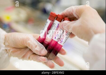 Primo piano dei campioni di sangue, studiati per determinare il tipo di sangue A, B, o, il fattore Rhesus-D e, a indicazione, la possibile presenza di potenziall Foto Stock