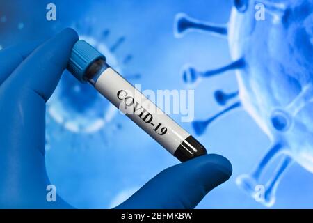 Individuazione del coronavirus, patogeno della malattia COVID-19. Provetta per analisi del sangue per analisi SARS-cov-2. Foto Stock