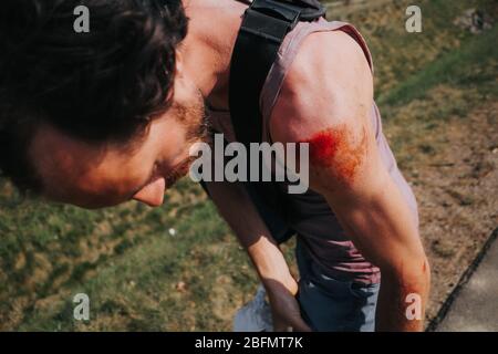 abrasione sulla spalla umana dopo un incidente di skateboard Foto Stock