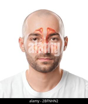 Uomo con illustrazione del seno paranasale su sfondo bianco. Concetto di asma Foto Stock