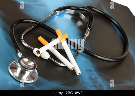 Stetoscopio medico su immagine a raggi X con sigarette da vicino Foto Stock
