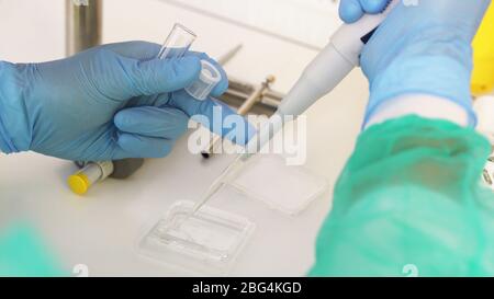 pipettaggio del campione da parte di scienziati in una piastra petri per analisi analitiche in laboratorio. primo piano. Foto Stock