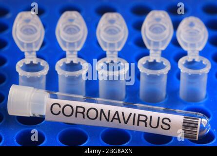 Protocollo di test con tecnologia CRISPR per la rivelazione di nuovi coronavirus Covid-19 SARS-Cov-2 Foto Stock