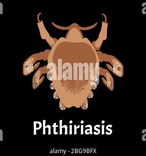 Malattie parassitarie di Phtiriasis. Pediculosi pubis. Struttura di ghiaccio pubico. Malattie sessualmente trasmissibili. Infografiche. Illustrazione del vettore attivata Illustrazione Vettoriale