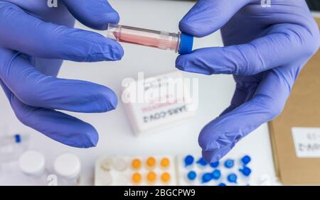 Lo scienziato esamina il campione di coronavirus in laboratorio, immagine concettuale Foto Stock