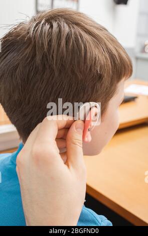 Installazione di apparecchi acustici sull'orecchio del bambino. Trattamento uditivo in clinica Foto Stock