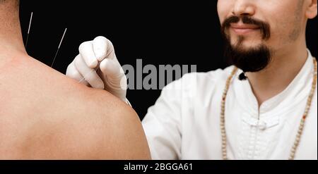 Aghi per agopuntura in primo piano sulla spalla di un uomo su sfondo nero. Un riflessologo molto accuratamente che fa agopuntura Foto Stock