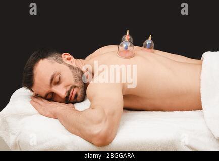 Trattamento della polmonite nell'uomo con coppe sottovuoto. Le vaschette a vuoto migliorano la circolazione sanguigna del paziente. Non dire polmonite Foto Stock