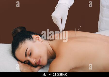 La donna gode della procedura di agopuntura. Un agopuncturist che fa agopuntura molto accuratamente. Primo piano dell'ago Foto Stock