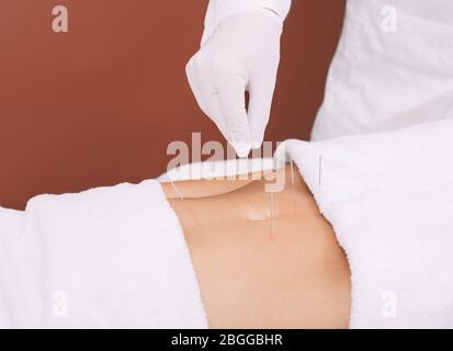 Agopuntura dell'addome di una donna per rimuovere il dolore addominale. Gli aghi per agopuntura si chiudono Foto Stock