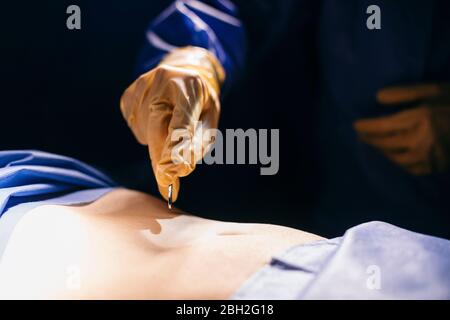 Primo piano del chirurgo che fa un incicione durante un'operazione Foto Stock