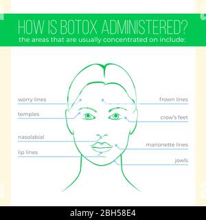 Come viene somministrato Botox. Poster. Illustrazione Vettoriale