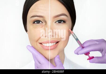 Confronto viso donna con rughe e viso giovane liscio dopo iniezioni di bellezza. Pelle del viso invecchiata prima e pelle giovane sollevante dopo la procedura Foto Stock