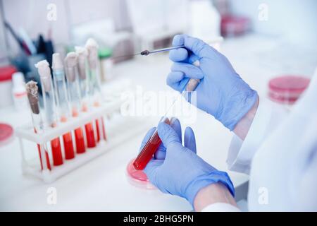 Donna medica che lavora con il campione di sangue in laboratorio, colore blu Foto Stock