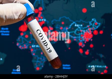 La pandemia COVID-19. Una provetta con un campione sullo sfondo della mappa di incidenza. Foto Stock