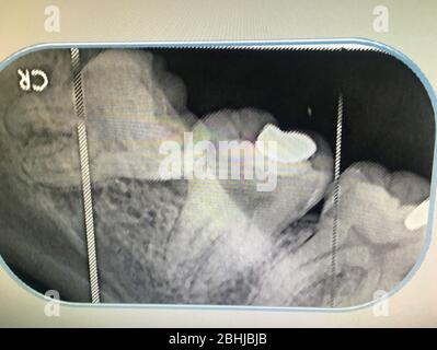 Foto del film radiografico dei denti diagnosticato nella clinica dentale di Bangkok Thailandia; Thailandia 1 dicembre 2018 Foto Stock