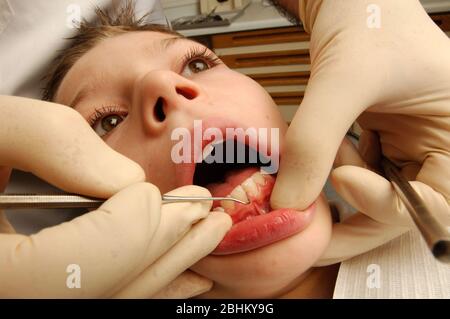 Un dentista raschia via la placca dai denti di un giovane ragazzo. Foto Stock