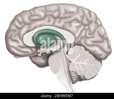 Illustrazione medica che rappresenta la malattia di Huntington, un disturbo genetico che coinvolge il gene HD (malattia di Huntington) del cromosoma 4 con re anormale Foto Stock