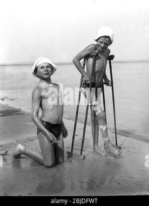 Bambini con Rickets esposti alla luce del sole giovani ragazzi che sono trattati in un sanitorium in Hampshire Inghilterra nel 1925. Trattamento farmaco salute malnutrizione povera Gran Bretagna cura la terapia della luce nursing1930 Foto Stock