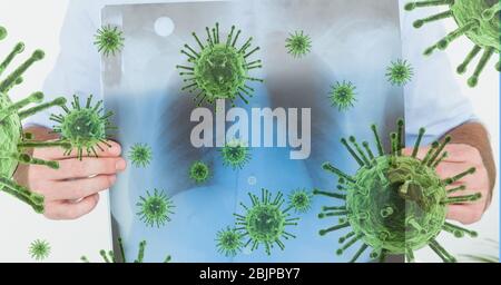 Illustrazione digitale di una persona che ha una scansione a raggi X dei suoi polmoni su macro Coronavirus Covid-19 c Foto Stock