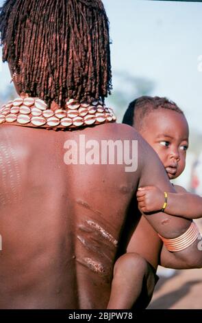 Le cicatrici crude sulla schiena di una donna Hamar dopo essere stato montato in una cerimonia 'salto del toro'. Fotografato nella Valle del fiume Omo, Etiopia Foto Stock