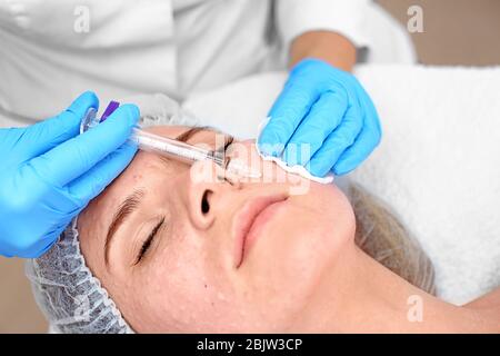 Estetista rendendo iniezione nel volto di donna, primo piano. Procedura Biorevitalization Foto Stock